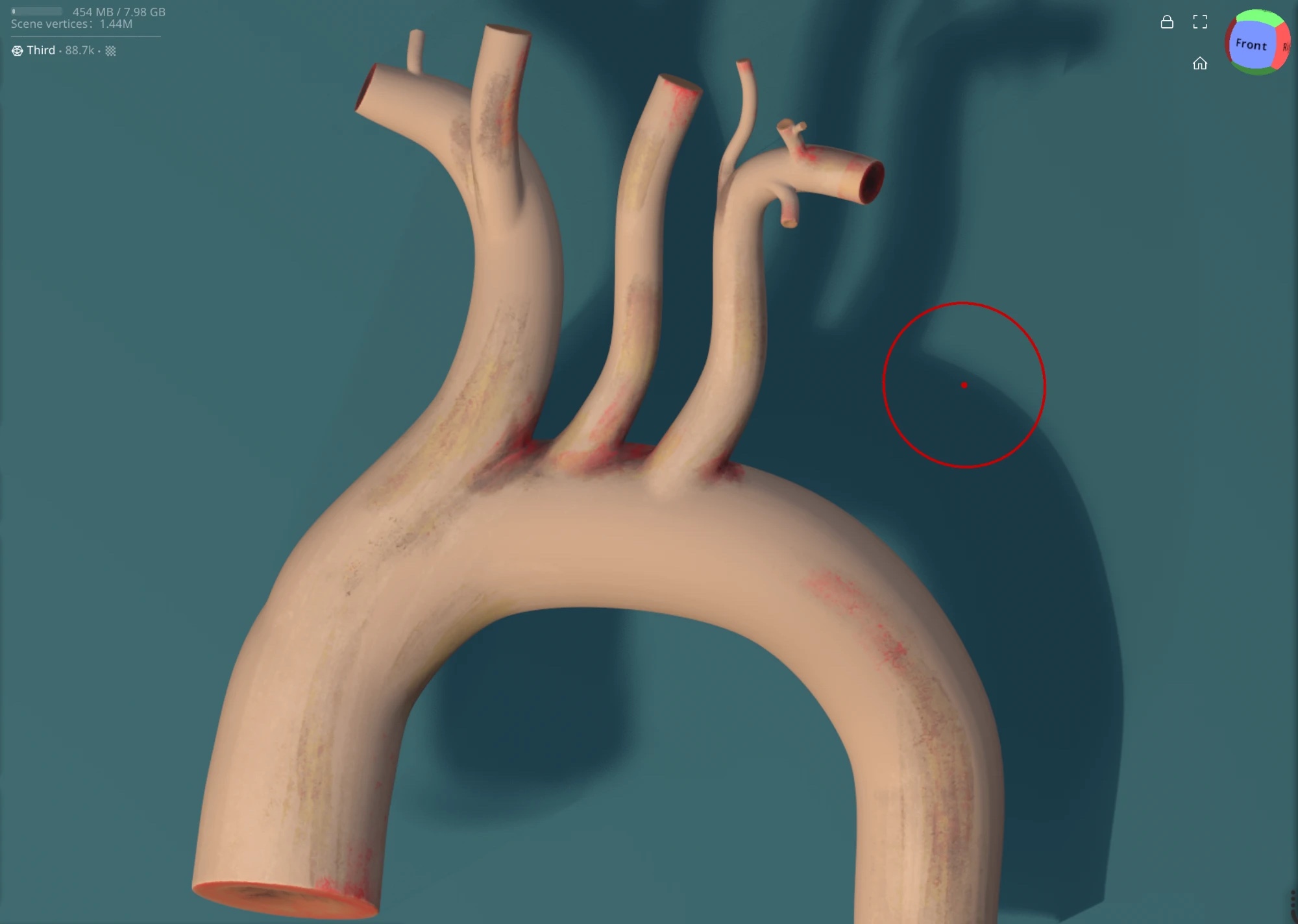 3D sculpt of an aortic arch in progress